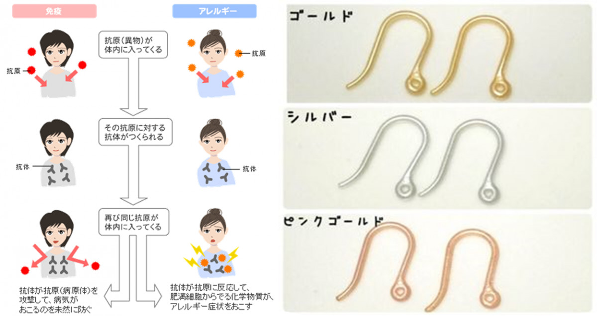 白色合金めっき